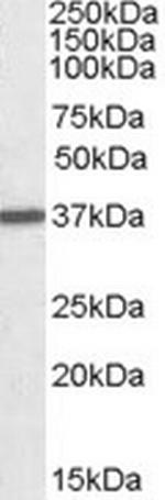 Arginase 1 Antibody in Western Blot (WB)