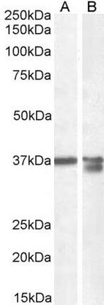 Arginase 1 Antibody in Western Blot (WB)