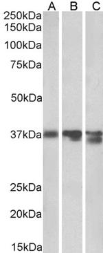 Arginase 1 Antibody in Western Blot (WB)