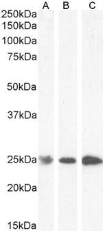 GSTP1 Antibody in Western Blot (WB)