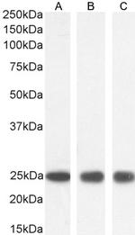 GSTP1 Antibody in Western Blot (WB)