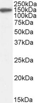 Complement Factor H Antibody in Western Blot (WB)