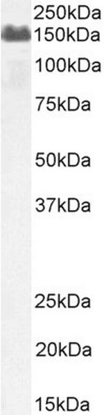 Complement Factor H Antibody in Western Blot (WB)