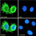 SDHB Antibody in Immunocytochemistry (ICC/IF)