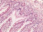 SDHB Antibody in Immunohistochemistry (Paraffin) (IHC (P))