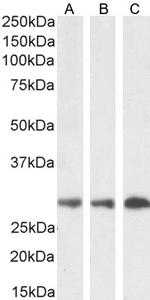 SDHB Antibody in Western Blot (WB)