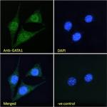 GATA1 Antibody in Immunocytochemistry (ICC/IF)