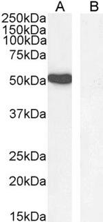 GATA1 Antibody in Western Blot (WB)