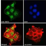 MEFV Antibody in Immunocytochemistry (ICC/IF)