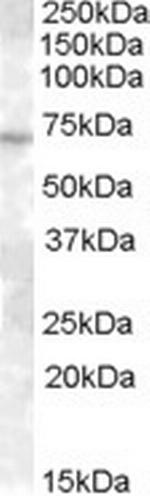 ABCE1 Antibody in Western Blot (WB)