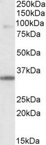 LDB3 Antibody in Western Blot (WB)