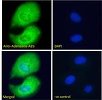 ADORA2B Antibody in Immunocytochemistry (ICC/IF)