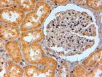 ADORA2B Antibody in Immunohistochemistry (Paraffin) (IHC (P))