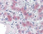 PCK1 Antibody in Immunohistochemistry (Paraffin) (IHC (P))