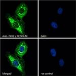 PCK2 Antibody in Immunocytochemistry (ICC/IF)