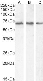 PCK2 Antibody in Western Blot (WB)