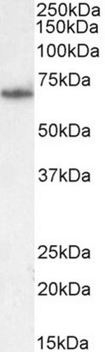 PCK2 Antibody in Western Blot (WB)