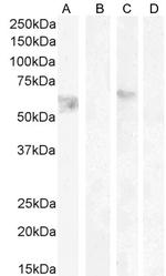 Cannabinoid Receptor 1 Antibody in Western Blot (WB)