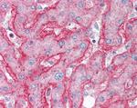 ENPP1 Antibody in Immunohistochemistry (Paraffin) (IHC (P))