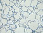 ENPP1 Antibody in Immunohistochemistry (Paraffin) (IHC (P))