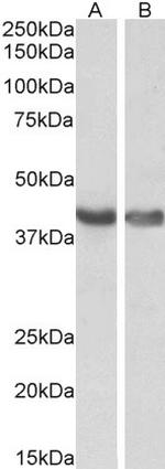 HEXIM1 Antibody in Western Blot (WB)