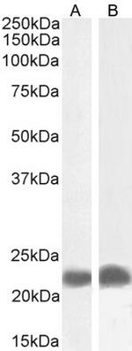 TIRAP Antibody in Western Blot (WB)