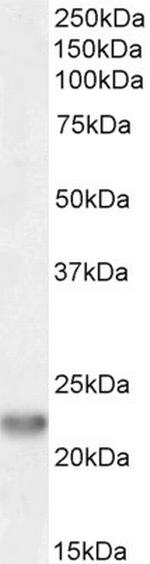 TIRAP Antibody in Western Blot (WB)