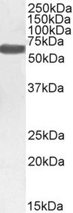 Monoamine Oxidase B Antibody in Western Blot (WB)