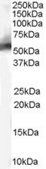 MDM2 Antibody in Western Blot (WB)