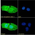 KPNB1 Antibody in Immunocytochemistry (ICC/IF)