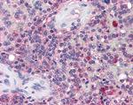 KPNB1 Antibody in Immunohistochemistry (Paraffin) (IHC (P))