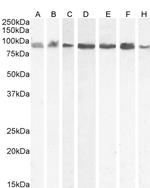 KPNB1 Antibody in Western Blot (WB)