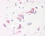 RPS19 Antibody in Immunohistochemistry (Paraffin) (IHC (P))