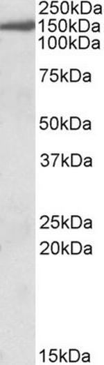 EPB41L3 Antibody in Western Blot (WB)