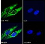 PTCH Antibody in Immunocytochemistry (ICC/IF)