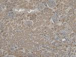 VPS25 Antibody in Immunohistochemistry (Paraffin) (IHC (P))