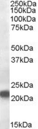 VPS25 Antibody in Western Blot (WB)