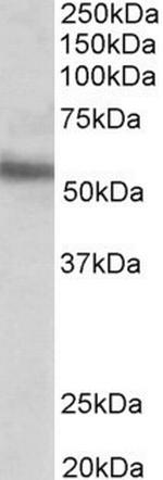 ERG Antibody in Western Blot (WB)