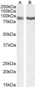 IFT88 Antibody in Western Blot (WB)