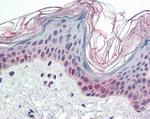 PARP2 Antibody in Immunohistochemistry (Paraffin) (IHC (P))