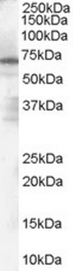 PARP2 Antibody in Western Blot (WB)