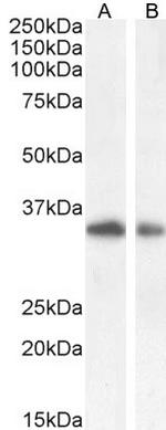 TIM3 Antibody in Western Blot (WB)