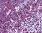 Stathmin 1 Antibody in Immunohistochemistry (Paraffin) (IHC (P))