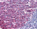 Stathmin 1 Antibody in Immunohistochemistry (Paraffin) (IHC (P))