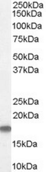 Stathmin 1 Antibody in Western Blot (WB)