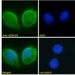 alpha-2a Adrenergic Receptor Antibody in Immunocytochemistry (ICC/IF)