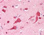 DDX6 Antibody in Immunohistochemistry (Paraffin) (IHC (P))