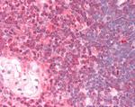 DDX6 Antibody in Immunohistochemistry (Paraffin) (IHC (P))