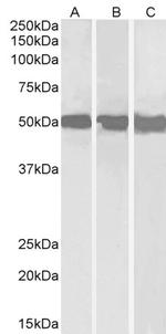 DDX6 Antibody in Western Blot (WB)