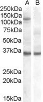 AGO1 Antibody in Western Blot (WB)